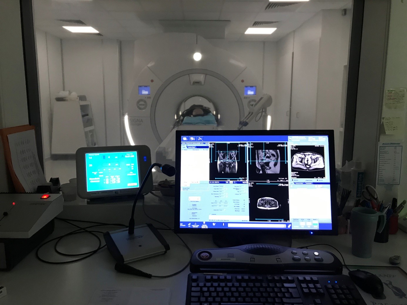 Photographie d'une radio